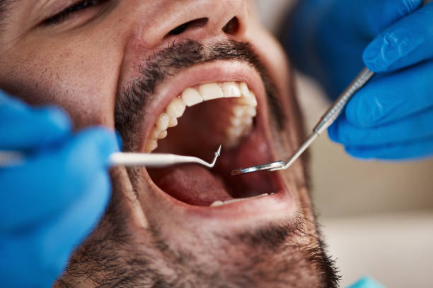 Best Broken or Chipped Tooth Repair in Adelino, NM
